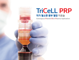 TriCeLL PRP
